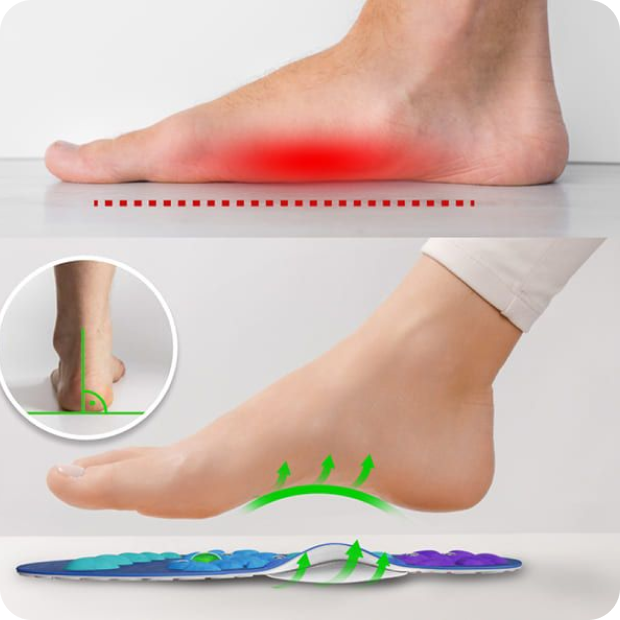 Akusoli Arch Support Inserts