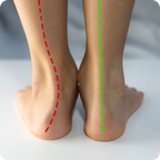 Akusoli Arch Support Inserts