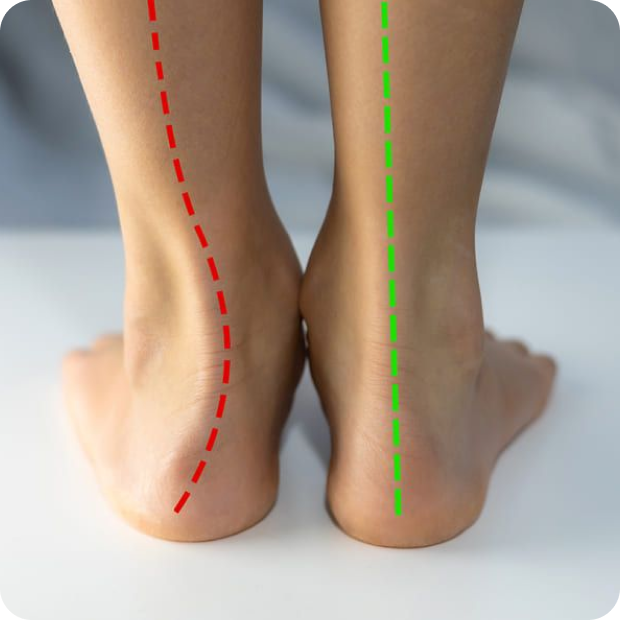 Akusoli Arch Support Inserts