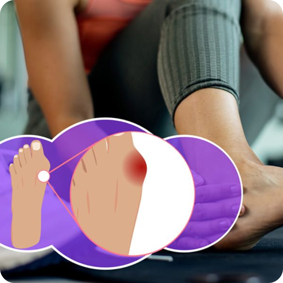Akusoli Bunion Wrap