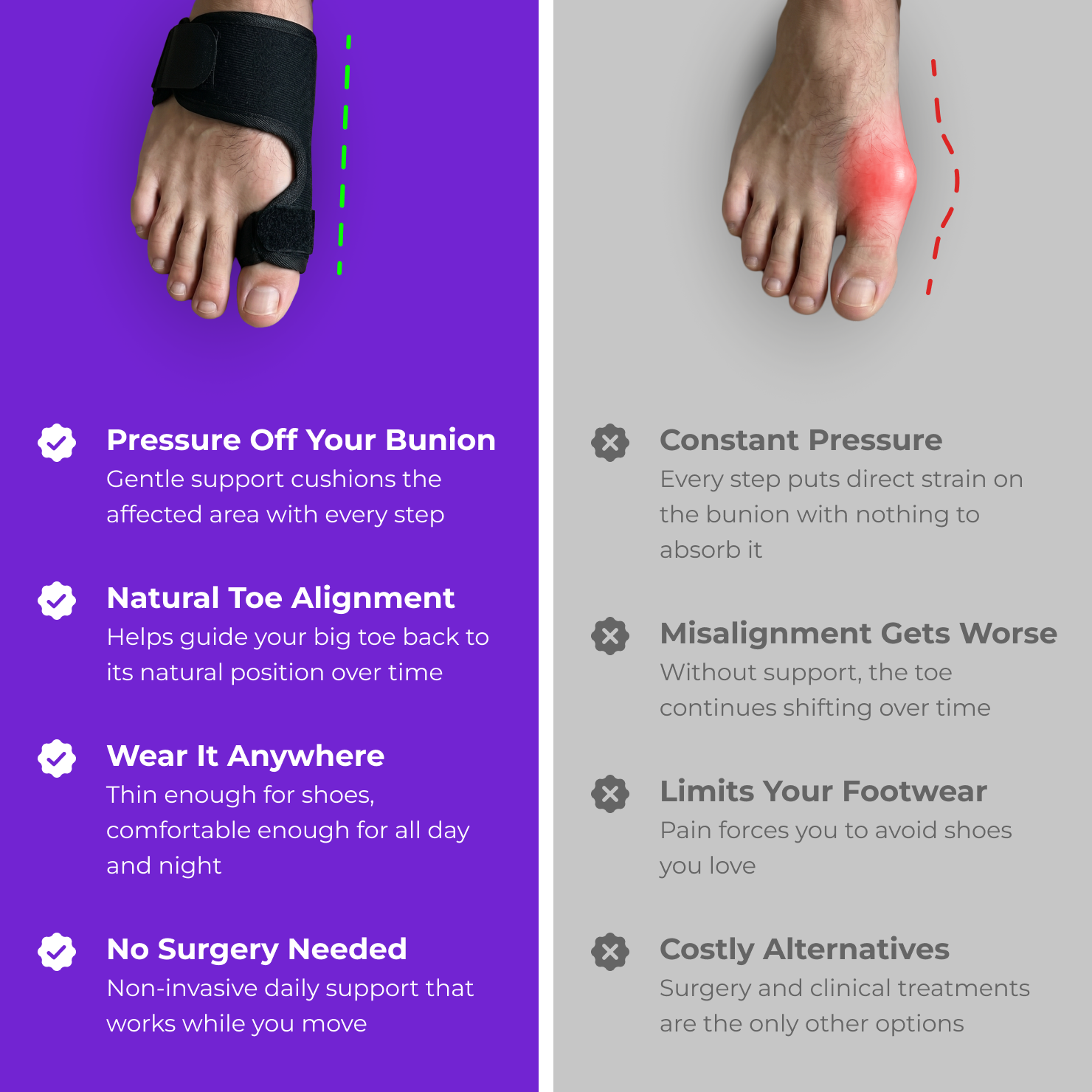 Akusoli Bunion Wrap